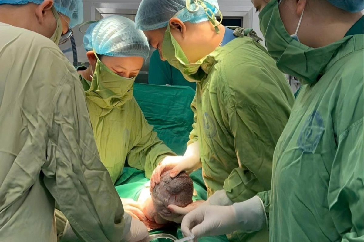 Bác sĩ Trung tâm Y học bào thai Bệnh viện Phụ sản Trung ương thực hiện ca mổ lấy thai cho một trường hợp can thiệp bào thai, đặt dẫn lưu màng phổi thai nhi tuần thứ 32.