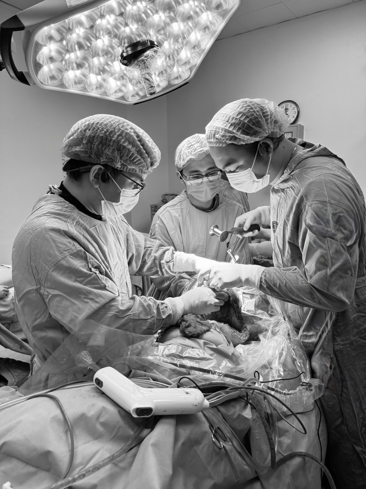Ê kíp phẫu thuật BV K cơ sở Quán sứ phẫu thuật loại bỏ hoàn toàn tổn thương xương, thay khớp háng cho người bệnh.