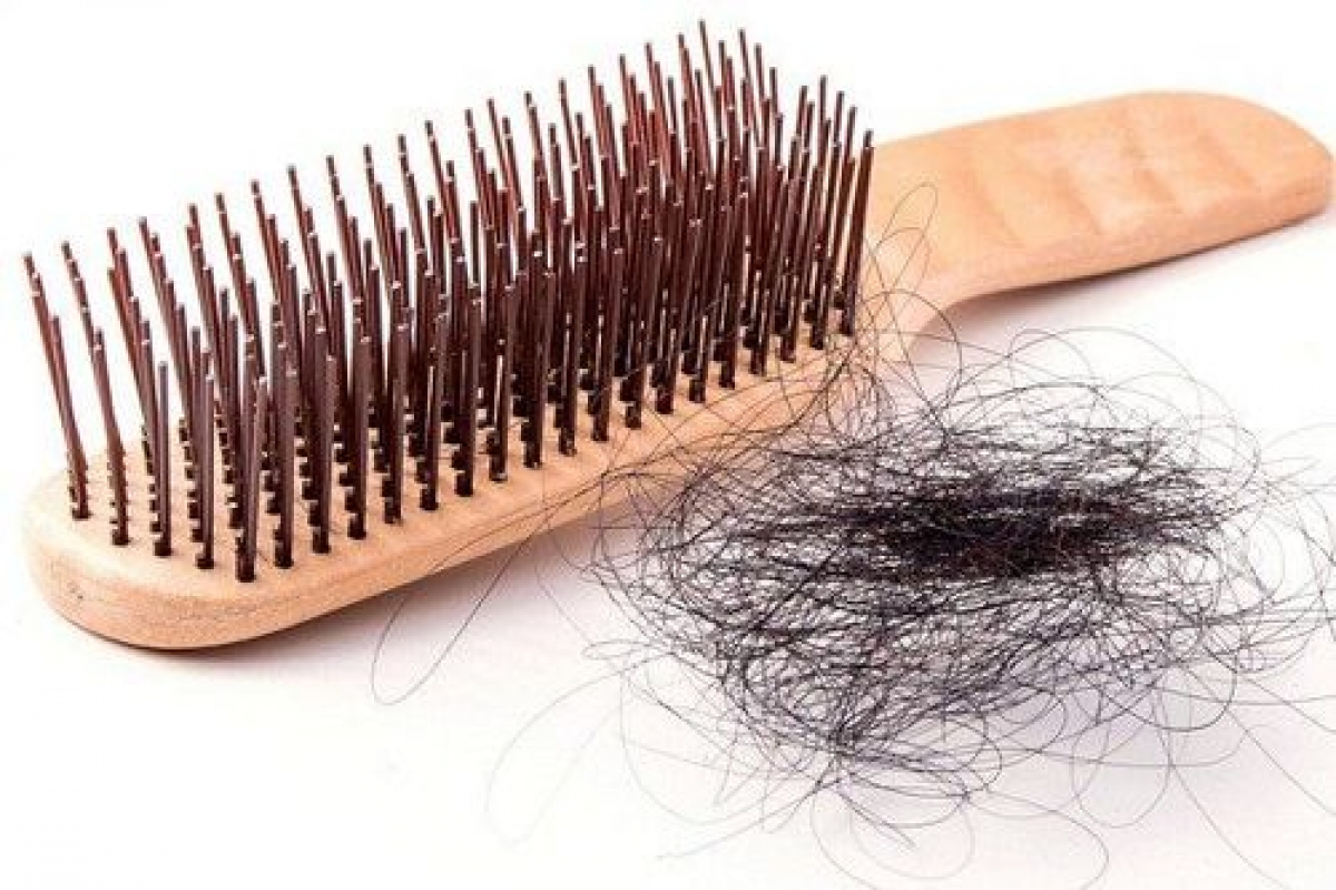 Khi bị rụng tóc nhiều, rụng tóc bất thường, người dân cần đến các cơ sở y tế chuyên khoa da liễu để được khám và điều trị kịp thời
